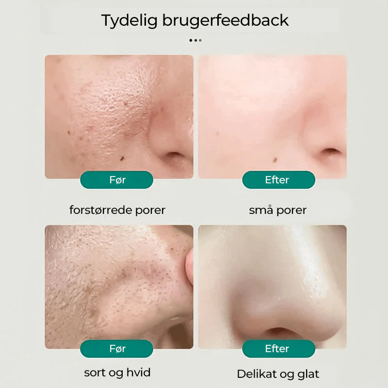 Southern Xiehe Niacinamide blegende ansigtsrens
